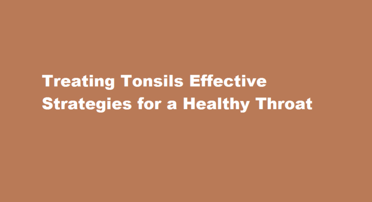How to treat tonsils