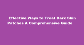  Effective Ways to Treat Dark Skin Patches A Comprehensive Guide