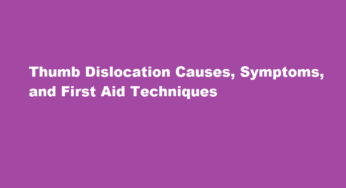 Thumb Dislocation Causes, Symptoms, and First Aid Techniques