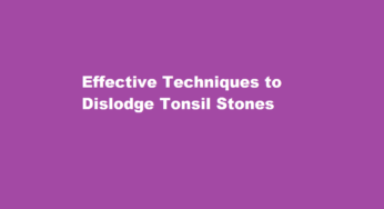 Effective Techniques to Dislodge Tonsil Stones