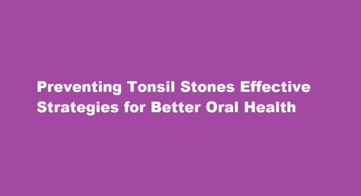 how to prevent tonsil stones