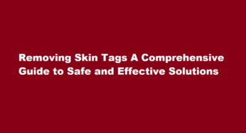 Removing Skin Tags A Comprehensive Guide to Safe and Effective Solutions