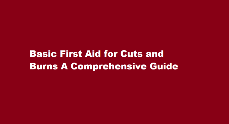 How to perform basic first aid for cuts and burns